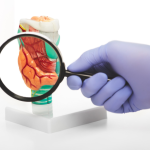 Gustavo Luíz Guilherme Pinto explica o que são as doenças autoimunes, seus principais tipos e como elas impactam o equilíbrio do corpo.