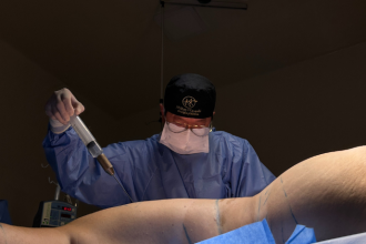 Milton Seigi Hayashi apresenta os tratamentos mais eficazes para combater a flacidez abdominal com segurança.